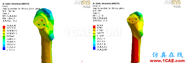 “倒品字”与“品字”空心钉不同Pauwels分型骨折的生物力学性能研讨ansys分析图片5